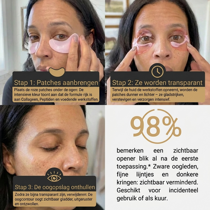 LuminaLift - Revitaliserende Oogpatches met PDRN & Collageen