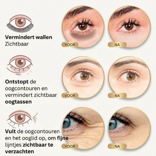LuminaLift - Revitaliserende Oogpatches met PDRN & Collageen